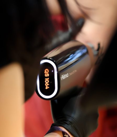 Laser skin treatment at SubRosa Med Spa in Atlanta improving skin tone and texture